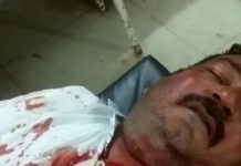 मामूली बात पर भिड़े दो पक्ष , हुई मारपीट , 1 घायल |