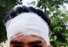 सहपऊ : आपसी की मारपीट में युवक का सिर फटा